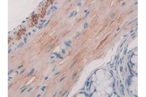 Immunohistochemistry (IHC) image for anti-Major Histocompatibility Complex, Class II, DR beta 1 (HLA-DRB1) (AA 27-264) antibody (ABIN7440767)