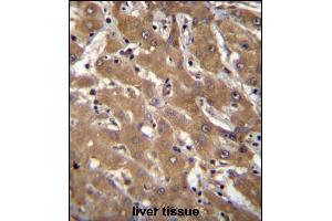 Immunohistochemistry (Paraffin-embedded Sections) (IHC (p)) image for anti-Speckle-Type POZ Protein-Like (SPOPL) (AA 221-249) antibody (ABIN656695)