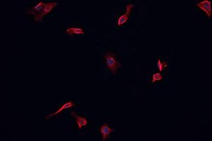 ABIN6266622 staining CACO-2 cells by IF/ICC. (PDGFRA Antikörper  (Internal Region))