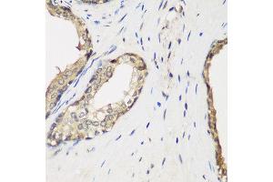 Immunohistochemistry of paraffin-embedded human prostate using METTL7A antibody at dilution of 1:200 (40x lens).