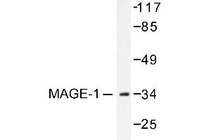 Image no. 1 for anti-Melanoma Antigen Family A, 1 (Directs Expression of Antigen MZ2-E) (MAGEA1) antibody (ABIN265510) (MAGEA1 Antikörper)