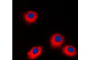 Immunofluorescent analysis of ERAS staining in Jurkat cells.