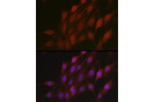 Immunofluorescence analysis of C6 cells using β-TrCP/BTRC Rabbit pAb (ABIN3022333, ABIN3022334, ABIN3022335 and ABIN6218745) at dilution of 1:100 (40x lens). (BTRC Antikörper  (AA 50-340))