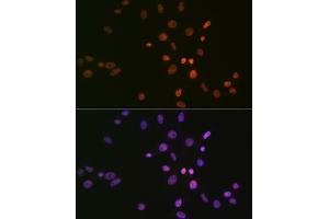 Immunofluorescence analysis of NIH-3T3 cells using SMC1 Rabbit mAb (ABIN7270614) at dilution of 1:100 (40x lens). (SMC1A Antikörper)