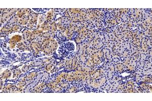 Immunohistochemistry (IHC) image for anti-Caspase 1 (CASP1) (AA 317-404) antibody (ABIN7438055)