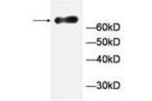 Image no. 1 for anti-General Transcription Factor IIA, 1-Like (GTF2A1L) antibody (ABIN791472) (GTF2A1L Antikörper)