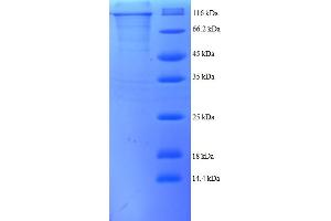 SDS-PAGE (SDS) image for Selenoprotein X, 1 (SEPX1) (AA 26-760) protein (GST tag) (ABIN4976120) (MSRB1 Protein (AA 26-760) (GST tag))