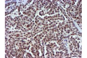 Image no. 6 for anti-Ubiquitin Specific Peptidase 7 (Herpes Virus-Associated) (USP7) antibody (ABIN1498592) (USP7 Antikörper)