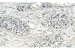 IHC analysis of AP2 Gamma/TFAP2C using anti-AP2 Gamma/TFAP2C antibody (ABIN7599099).