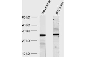dilution: 1 : 1000, sample: crude synaptosomal fraction of rat brain (P2) (SNAP25 Antikörper  (AA 192-206))