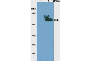 L1 rat brain lysates, L2 human colon carcinoma lysates probed with Anti- Phospho-CHK2(Thr68) Polyclonal Antibody, Unconjugated (ABIN703165) at 1:200 in 4 °C. (CHEK2 Antikörper  (pThr68))