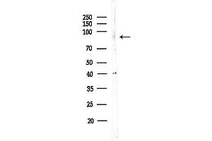 anti-Mediterranean Fever (MEFV) (N-Term) antibody