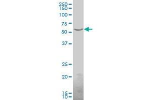Western Blotting (WB) image for anti-Polynucleotide Kinase 3'-Phosphatase (PNKP) (AA 422-521) antibody (ABIN564910)