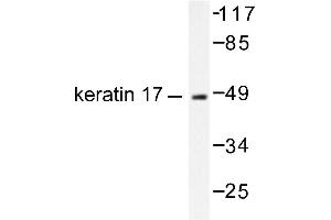 Image no. 1 for anti-Keratin 17 (KRT17) antibody (ABIN265496) (KRT17 Antikörper)