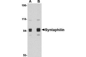 Western Blotting (WB) image for anti-Syntaphilin (SNPH) (Middle Region) antibody (ABIN1031114) (Syntaphilin Antikörper  (Middle Region))