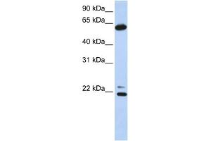 WB Suggested Anti-CCT5 Antibody Titration: 0.
