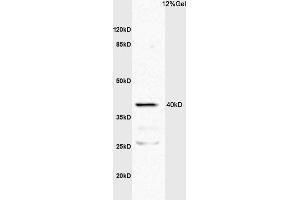 L1 mouse intestine lysates probed with Anti TNFR1/TNF Receptor I Polyclonal Antibody, Unconjugated (ABIN682018) at 1:200 overnight at 4 °C. (TNFRSF1A Antikörper  (AA 1-100))
