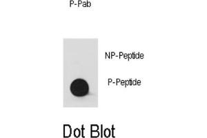 Dot Blot (DB) image for anti-V-Yes-1 Yamaguchi Sarcoma Viral Oncogene Homolog 1 (YES1) (pTyr530), (pTyr537) antibody (ABIN2970974) (YES1 Antikörper  (pTyr530, pTyr537))