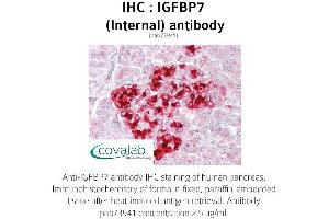 Image no. 1 for anti-Insulin-Like Growth Factor Binding Protein 7 (IGFBP7) (Internal Region) antibody (ABIN1735789) (IGFBP7 Antikörper  (Internal Region))