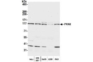 Western Blotting (WB) image for anti-Protein Kinase N2 (PKN2) (AA 200-250) antibody (ABIN7451962)