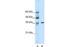 WB Suggested Anti-ZNF124 Antibody Titration:  2. (ZNF124 Antikörper  (N-Term))