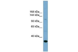 WB Suggested Anti-SLC9A1 Antibody Titration:  0. (SLC9A1 Antikörper  (Middle Region))