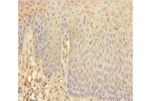 Immunohistochemistry of paraffin-embedded human tonsil tissue using ABIN7144104 at dilution of 1:100 (ANGPTL2 Antikörper  (AA 23-493))