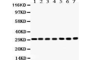 Western Blotting (WB) image for anti-Catechol-O-Methyltransferase (COMT) (AA 52-271) antibody (ABIN3043815)