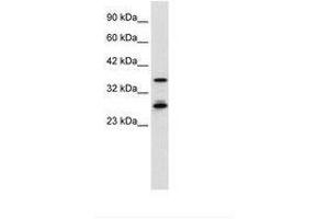 Image no. 1 for anti-Metal Response Element Binding Transcription Factor 2 (MTF2) (AA 26-75) antibody (ABIN6736029) (MTF2 Antikörper  (AA 26-75))