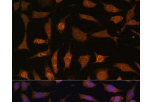 Immunofluorescence analysis of L929 cells using PDE6D Polyclonal Antibody at dilution of 1:100 (40x lens). (PDE6D Antikörper)