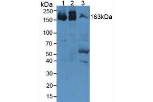 Figure. (alpha 2 Macroglobulin Antikörper  (AA 1053-1214))