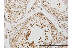 Immunoperoxidase of purified MaxPab antibody to DYX1C1 on formalin-fixed paraffin-embedded human testis. (DYX1C1 Antikörper  (AA 1-381))