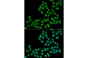 Immunofluorescence analysis of A549 cells using ELF1 antibody (ABIN5974153). (ELF1 Antikörper)