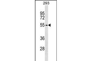 ZBTB6 Antibody (C-term) (ABIN1537261 and ABIN2849293) western blot analysis in 293 cell line lysates (35 μg/lane).