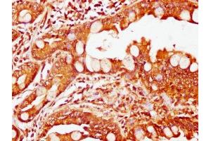 IHC image of ABIN7174242 diluted at 1:200 and staining in paraffin-embedded human small intestine tissue performed on a Leica BondTM system. (COQ3 Antikörper  (AA 271-369))