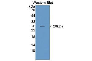 Western blot analysis of the recombinant protein. (FPGT Antikörper  (AA 314-513))
