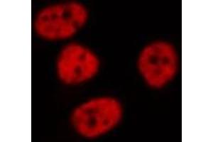 ABIN6268842 staining HeLa cells by IF/ICC. (MGMT Antikörper  (N-Term))