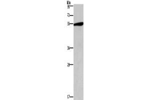 Western Blotting (WB) image for anti-5-Hydroxytryptamine (serotonin) Receptor 2C (HTR2C) antibody (ABIN2432626) (HTR2C Antikörper)