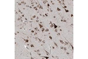 Immunohistochemical staining of human cerebral cortex with C2orf30 polyclonal antibody  shows cytoplasmic positivity in neuronal cells.