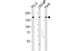 Western Blotting (WB) image for anti-Tuberous Sclerosis 2 (TSC2) (AA 1776-1805) antibody (ABIN390324)