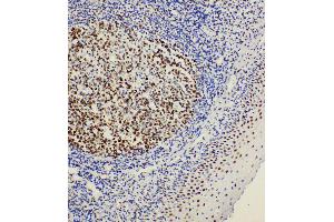 Anti-BOB1 antibody, IHC(P) IHC(P): Rat Tonsil Tissue (POU2AF1 Antikörper  (C-Term))