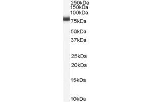 Western Blotting (WB) image for anti-Numb Homolog (NUMB) (C-Term) antibody (ABIN2465260) (NUMB Antikörper  (C-Term))