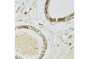 Immunohistochemistry of paraffin-embedded human breast using KLK10 Antibody (ABIN2563584) at dilution of 1:100 (40x lens). (Kallikrein 10 Antikörper)
