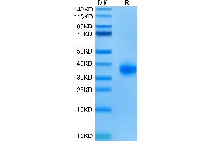 Biotinylated Human ULBP-2 on Tris-Bis PAGE under reduced condition. (ULBP2 Protein (His-Avi Tag,Biotin))