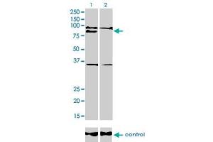 Western Blotting (WB) image for anti-Ring Finger Protein 141 (RNF141) (AA 141-230) antibody (ABIN599236) (RNF141 Antikörper  (AA 141-230))