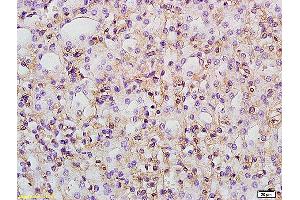 Formalin-fixed and paraffin embedded rat kidney labeled with Anti PTGER1/EP1 Polyclonal Antibody, Unconjugated at 1:200 followed by conjugation to the secondary antibody and DAB staining