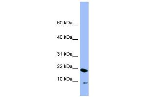 WB Suggested Anti-PIN4 Antibody Titration: 0.