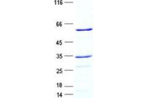 Western Blotting (WB) image for Deoxyribonuclease I (DNASE1) protein (GST tag,His tag) (ABIN5505616)