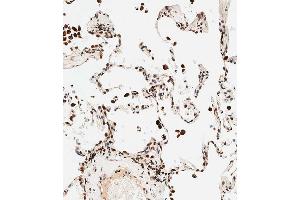 Immunohistochemical analysis of paraffin-embedded human lung tissue using B performed on the Leica® BOND RXm.