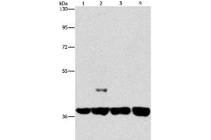 Western Blot analysis of 293T and 231 cell, U937 and Raji cell using SERPINA9 Polyclonal Antibody at dilution of 1:350 (SERPINA9 Antikörper)